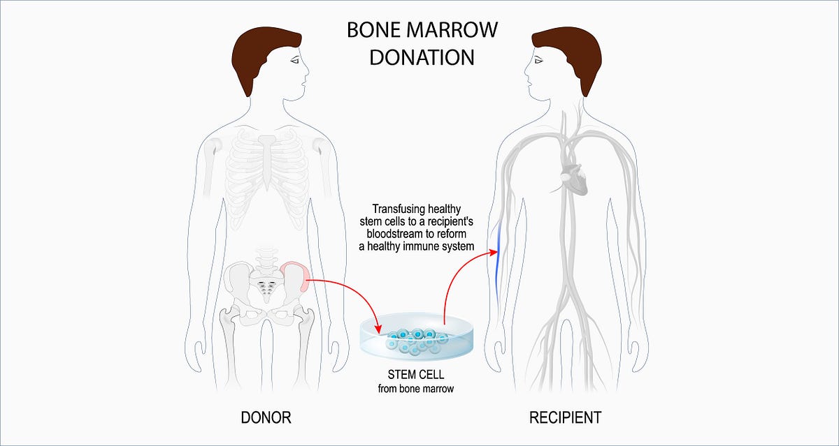 True Facts About Donating Bone Marrow by Jennifer Sheetal Medium