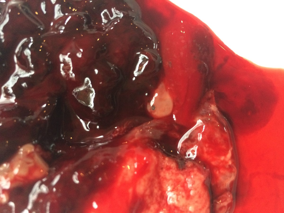 This is what happens to the bodies of the women you know. | by Courtney