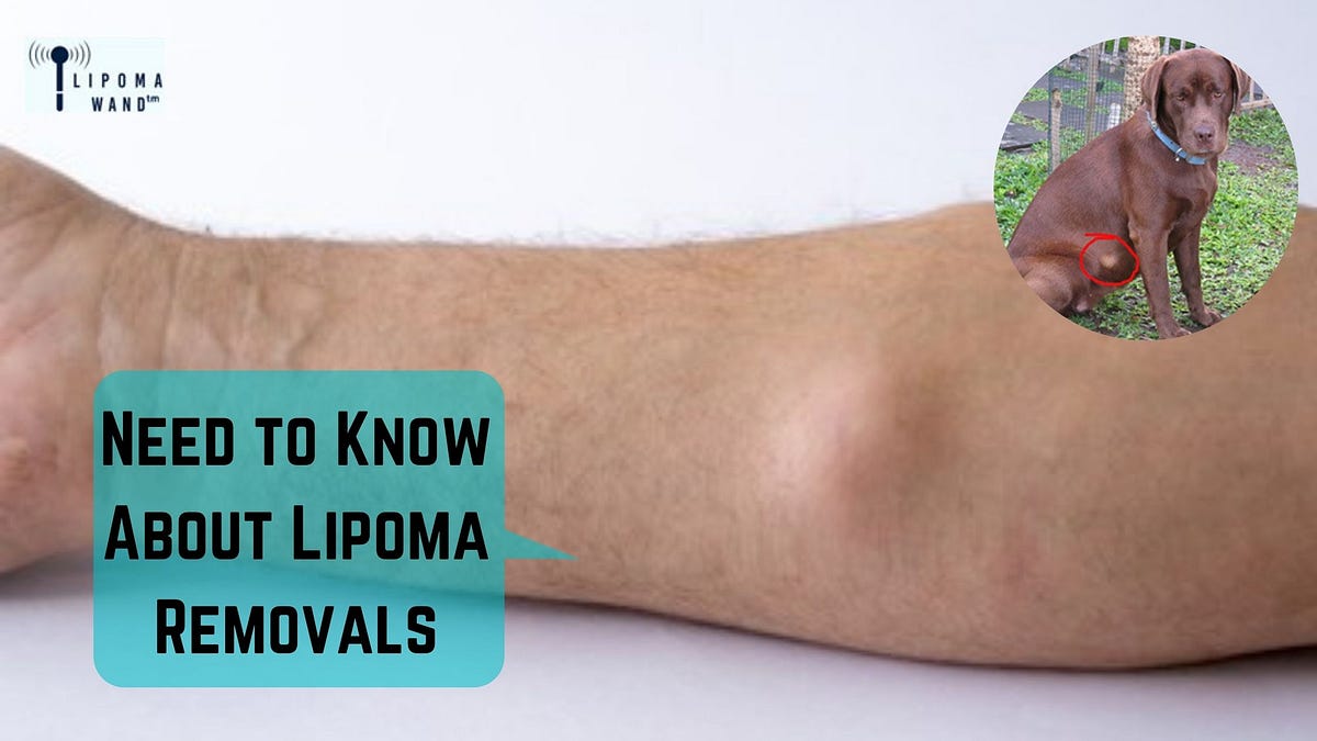 Need to Know About Lipoma in Dogs& Natural Lipoma Treatment Option by Jack Harison Medium