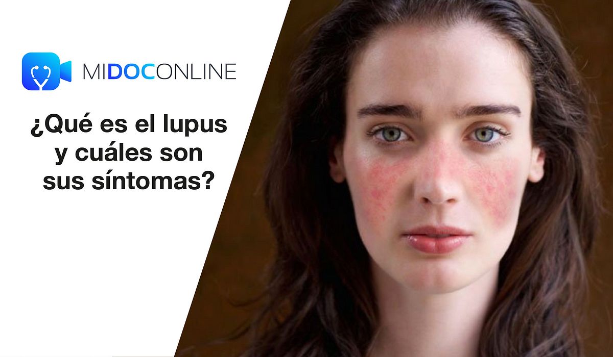 Qué es el lupus y cuáles son sus síntomas? by MIDOCONLINE Medium.