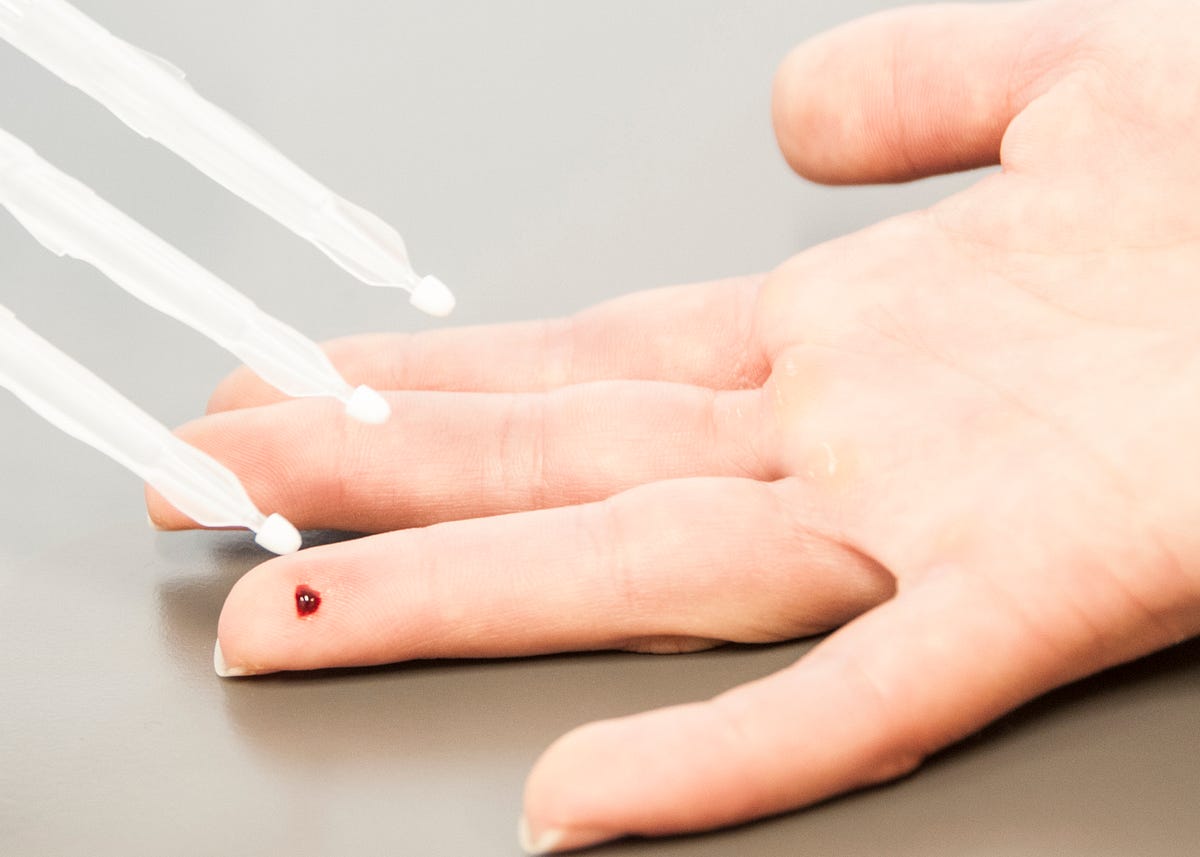 5 Common Capillary Puncture Sites by Neoteryx Medium