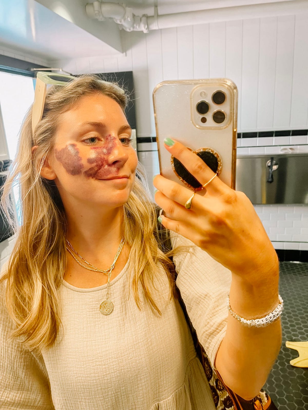 The Baylee Adami Leak: Will She Recover? - 3kw3zsq
