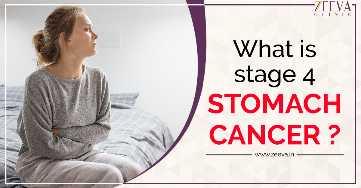 Stage 4 Stomach Cancer. What is advanced cancer? | by Zeeva Clinic | Medium