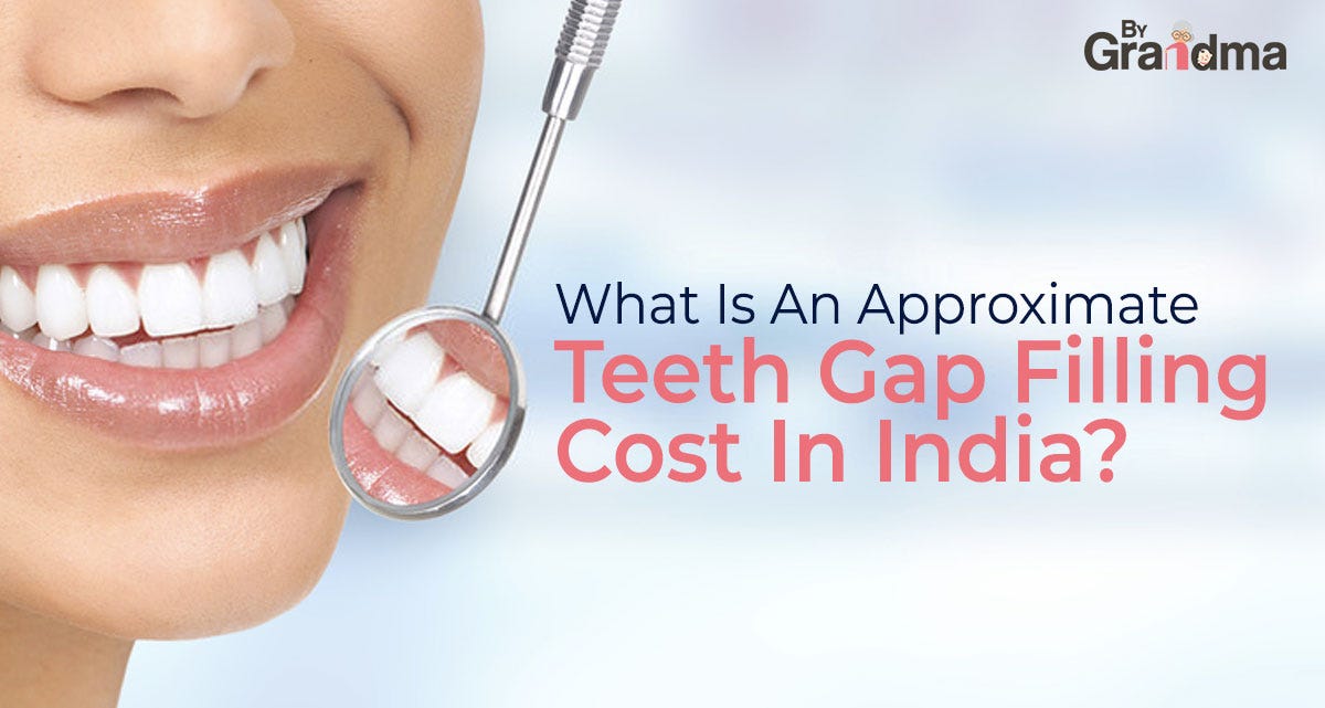 What Is An Approximate Teeth Gap Filling Cost In India? | by Leo Prabhu |  Nov, 2021 | Medium