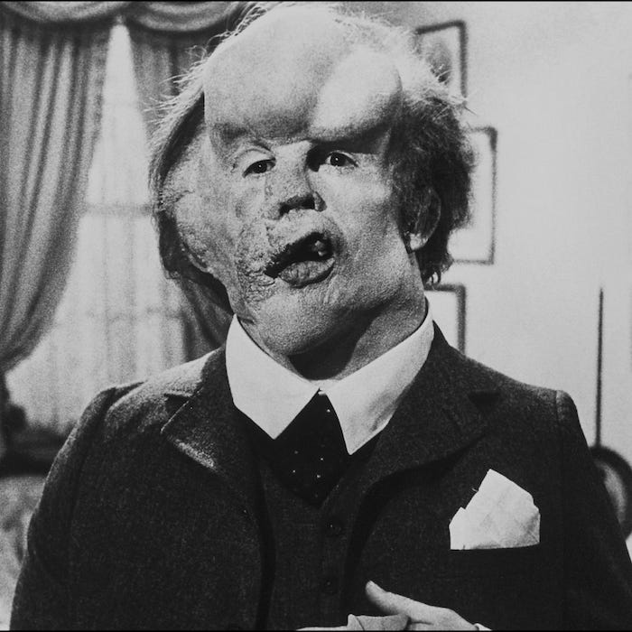 Image result for elephant man