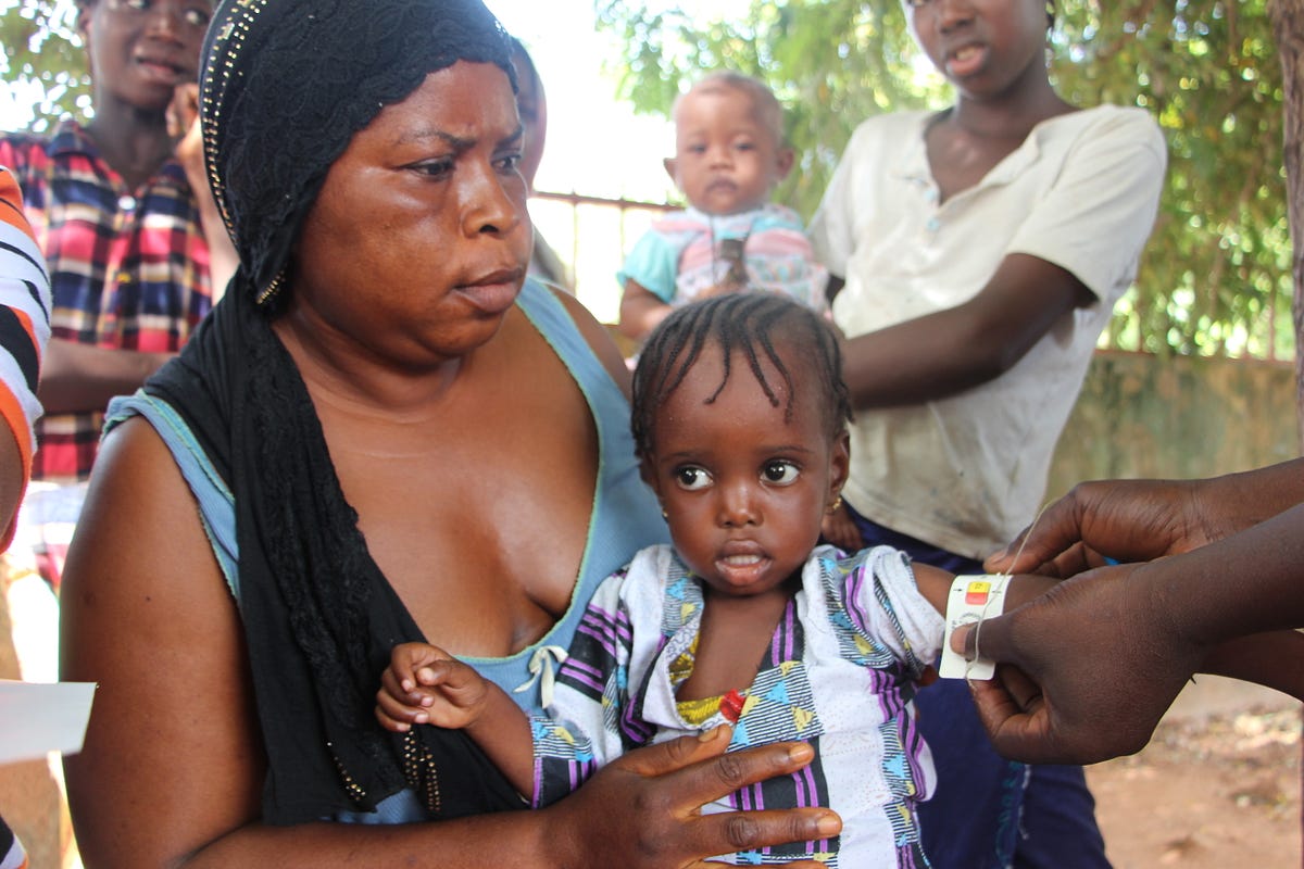 Fighting Malnutrition In The Gambia Critical During The Lean Season 