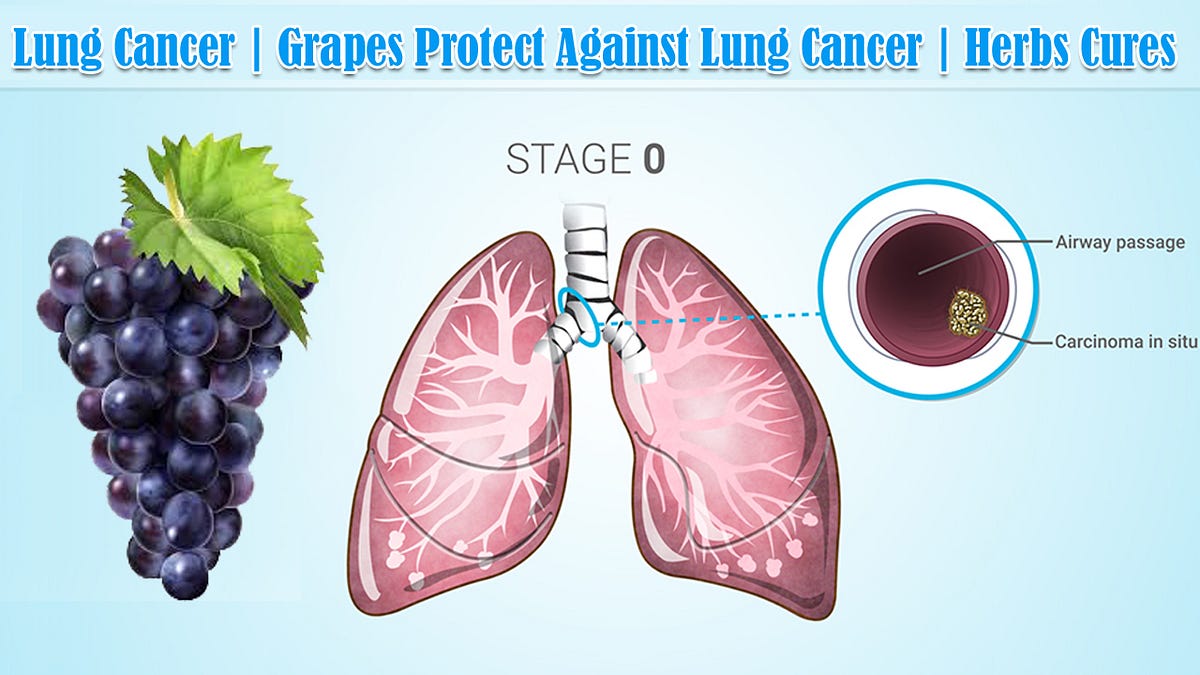 Lung Cancer Grapes Protect Against Lung Cancer Herbs Cures by
