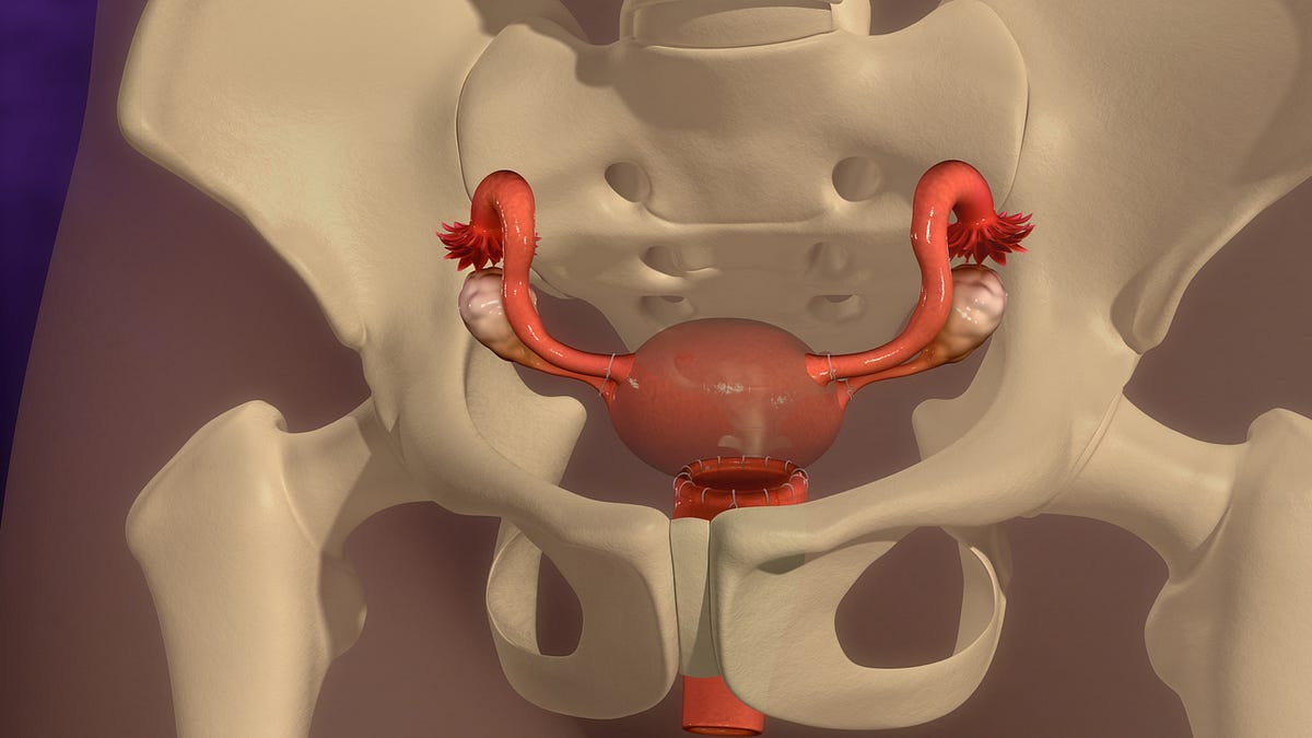 Patient Education Abdominal Hysterectomy Beyond The Basics Uptodate