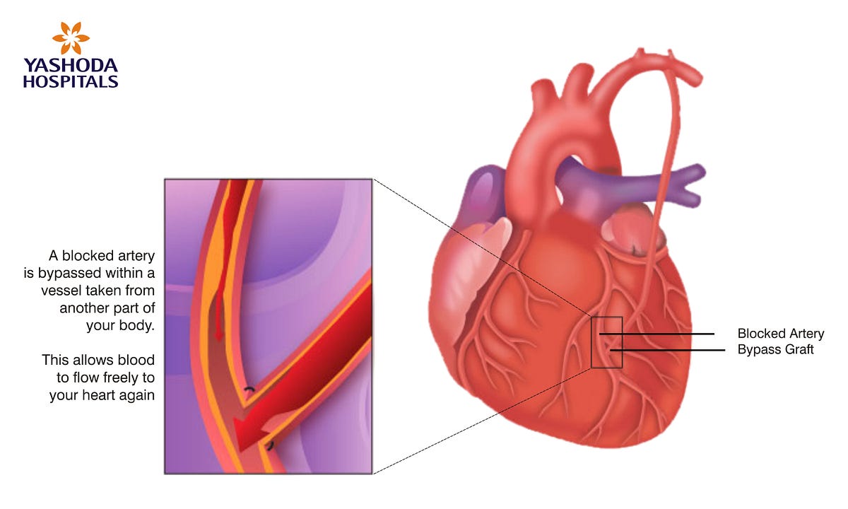Advances in Heart Surgery Techniques: A Comprehensive Overview