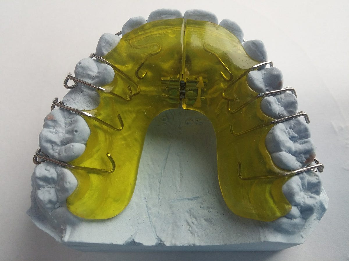 You Have To Wear Your Retainer Just Had Your Braces Removed After Many By Bensonhurst Dental Forever Young Medium