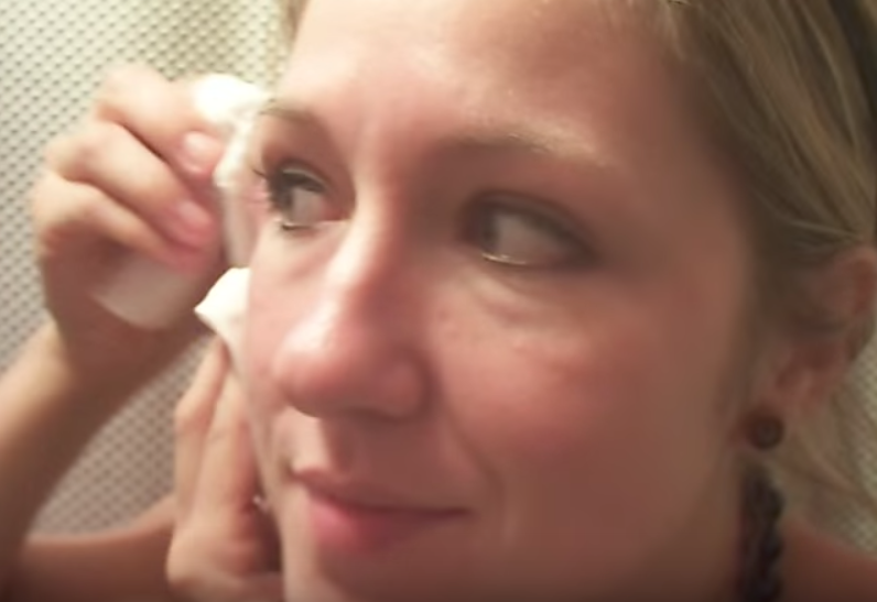 Popping Pimples On Your Face S Danger Triangle Can Kill You
