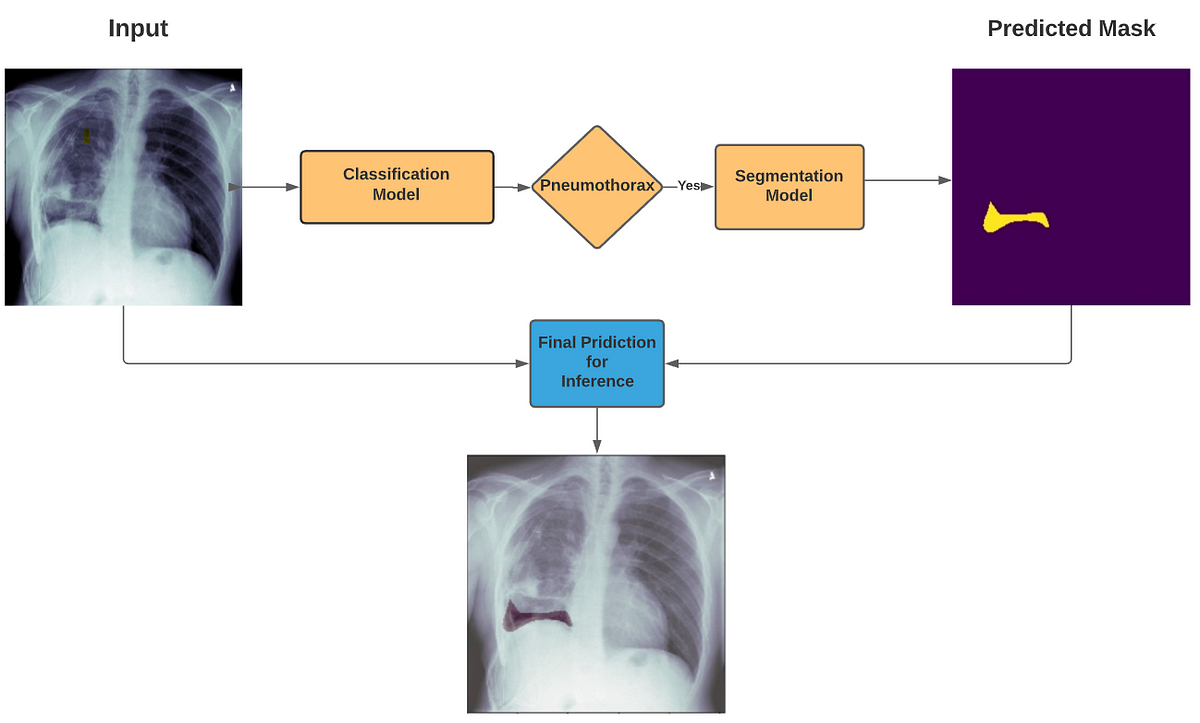 Semantic Segmentation for Pneumothorax Detection & Segmentation