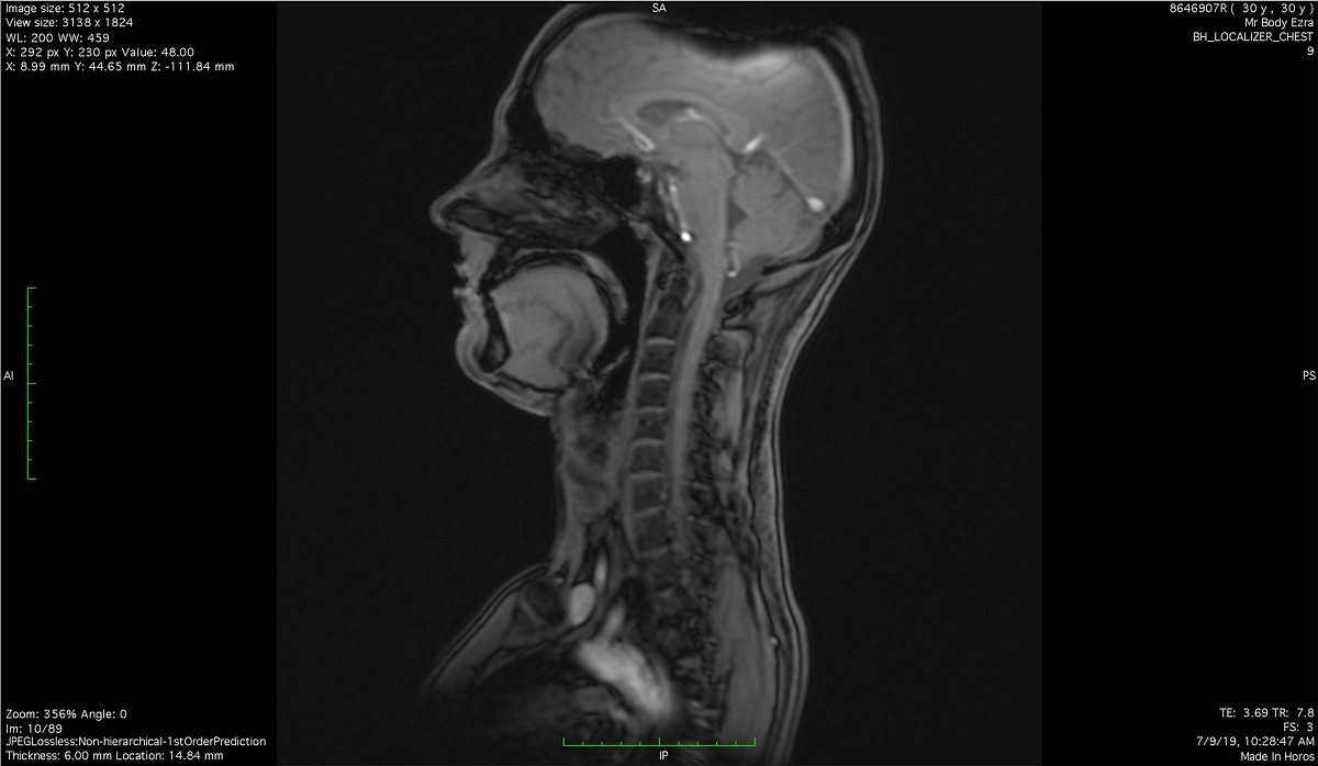 I Tried The Ezra Full Body Mri A Few Months Ago I Saw An Article In