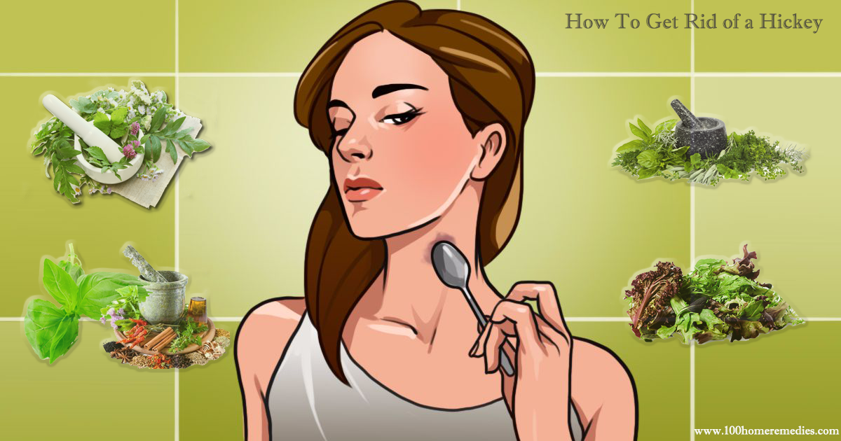 The Speedy Method To Get Rid of a Hickey Fast.