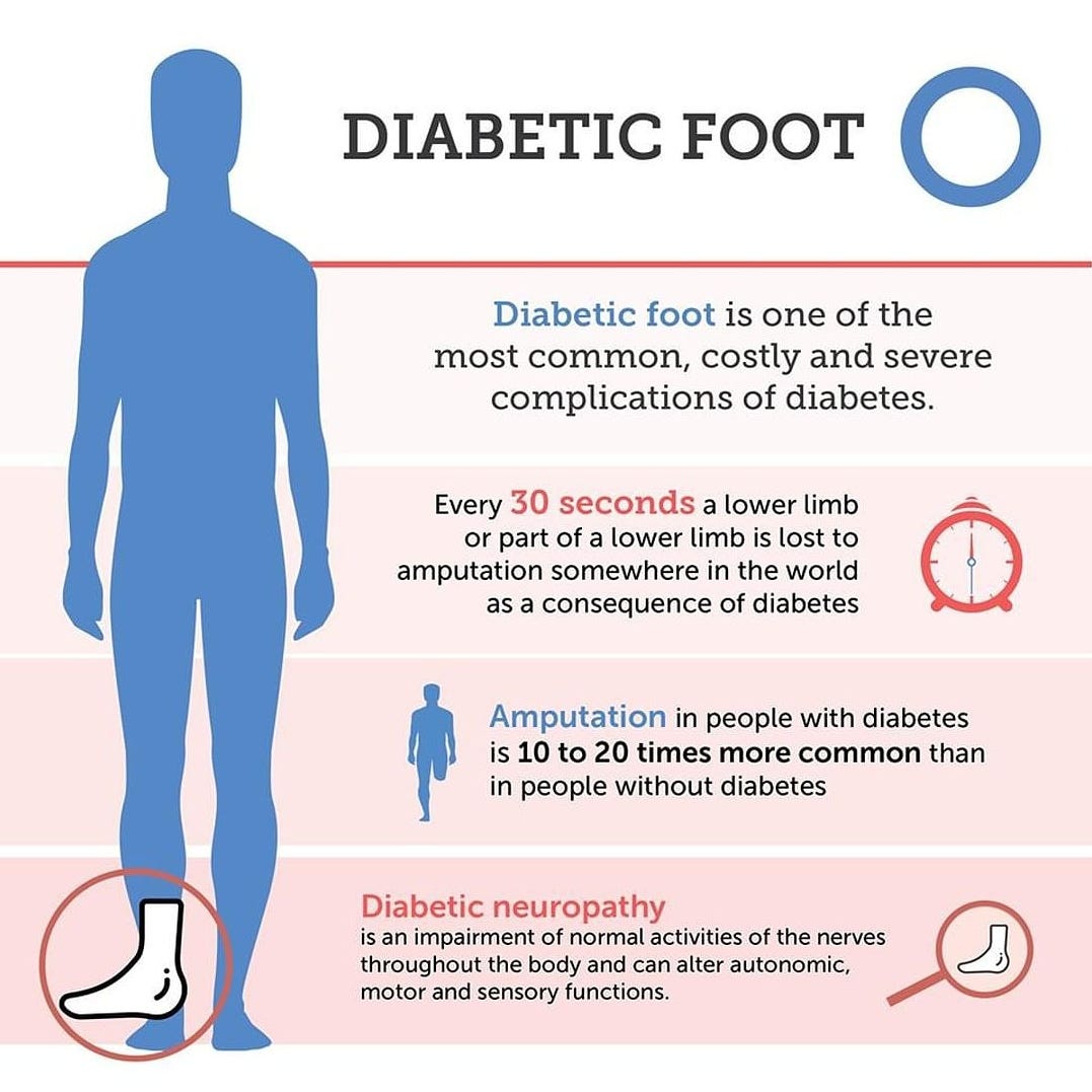 Importance Of General Diabetic Foot Care By Dr Brinsley Dr Brinsley Medium