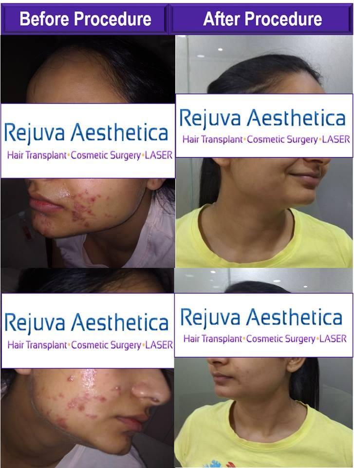 skin doctor near me for child