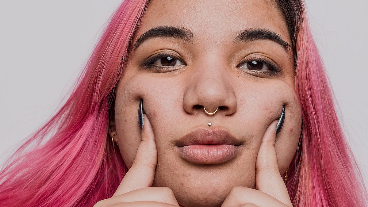 Acne on cheeks and what to do about it Curology