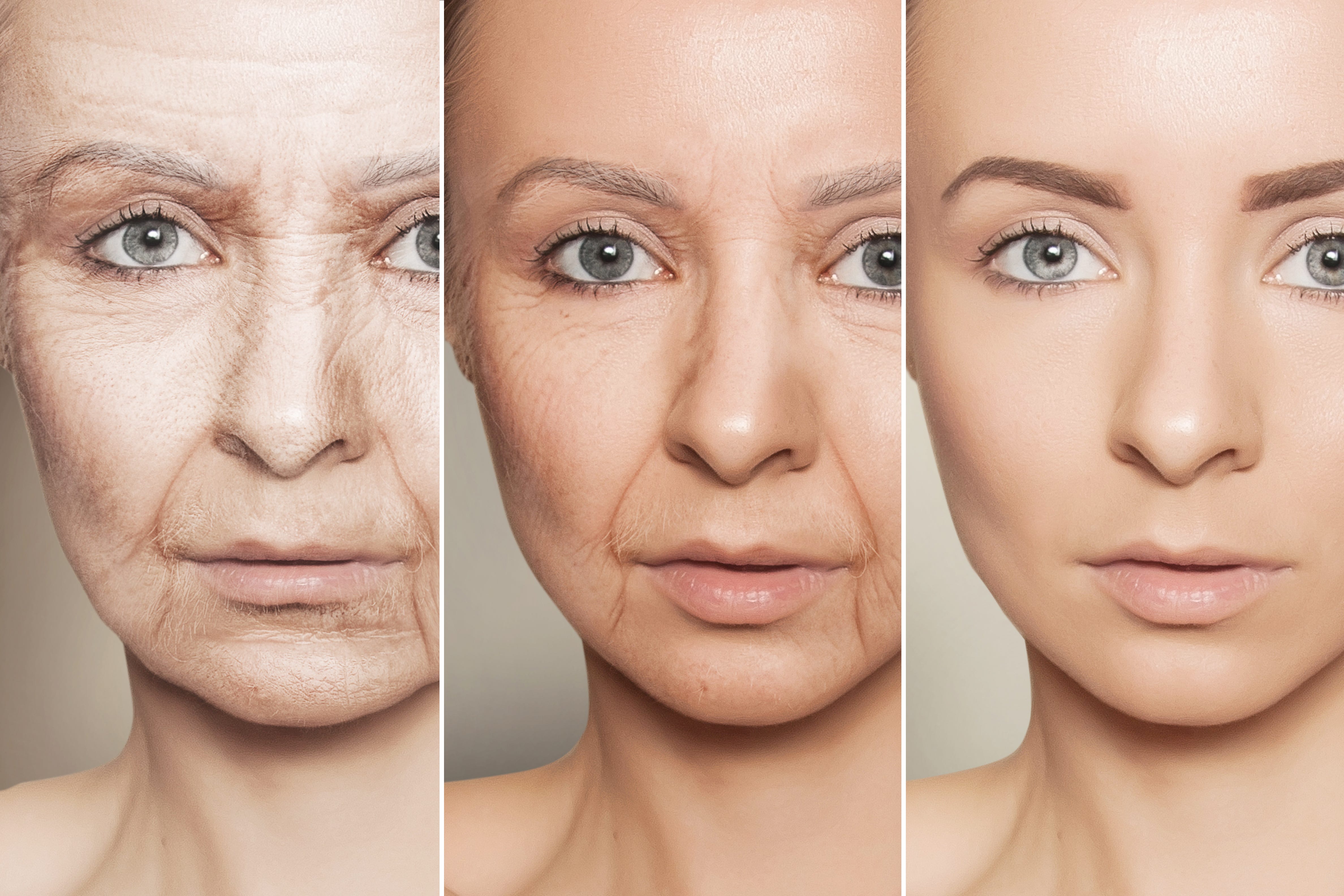 natural wrinkle treatment