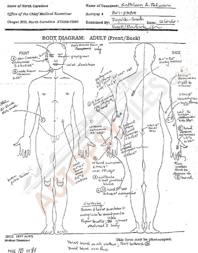 Kathleen peterson autopsy photos