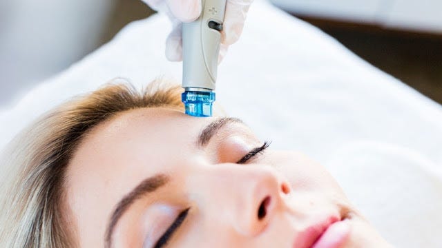 microdermabrasion facial