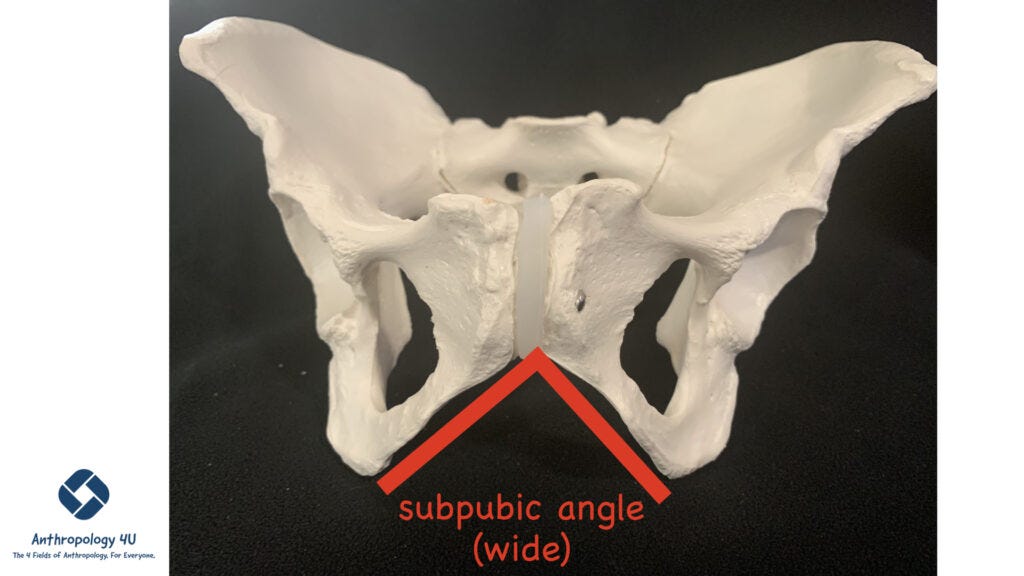 Forensic Anthropology One Way To Determine Sex From The Pelvis By