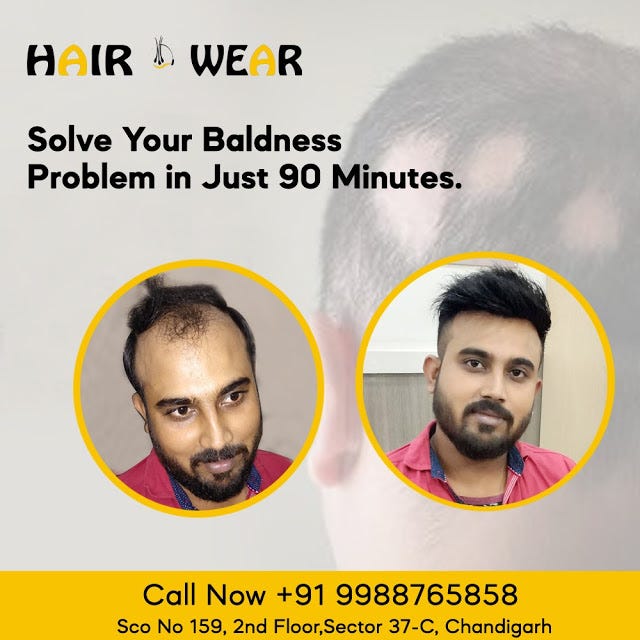 Hair Patches And Wig Services In Chandigarh Hair Wear Medium