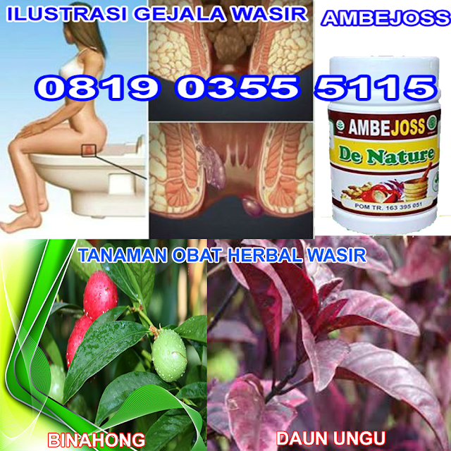 Bagaimana untuk menghilangkan benjolan hemoroid dengan 