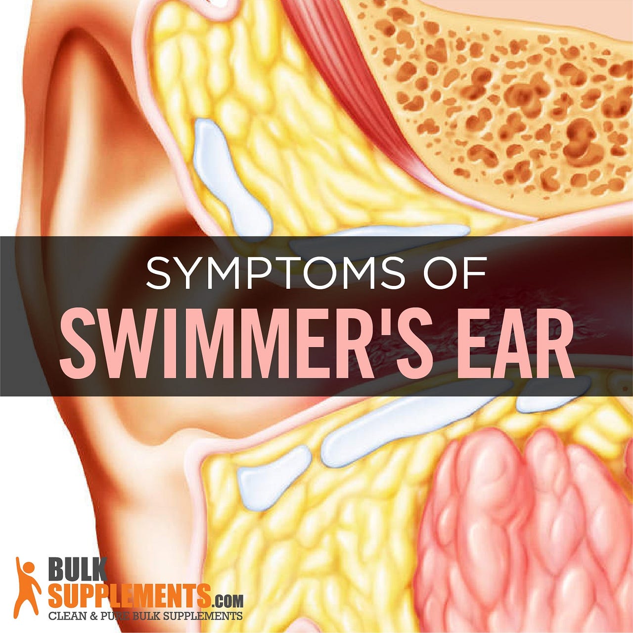 Swimmer’s Ear Symptoms, Causes & Treatment James Denlinger Medium