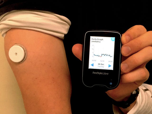 Continuous Glucose Monitoring — The First Four Weeks | by Justin Lawler |  Medium