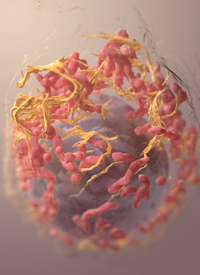 A 3D structure of a melanoma cell derived by ion abrasion scanning electron microscopy