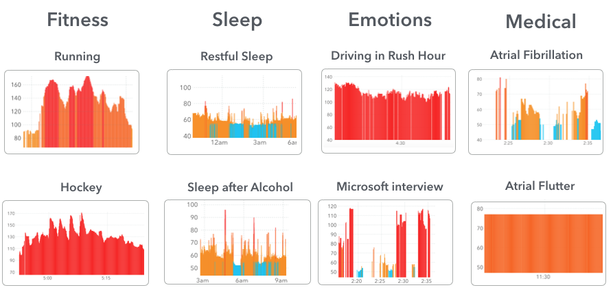 what-do-normal-and-abnormal-heart-rhythms-look-like-on-apple-watch