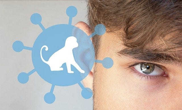 What Is Monkey Pox Virus: What You Need To Know?
