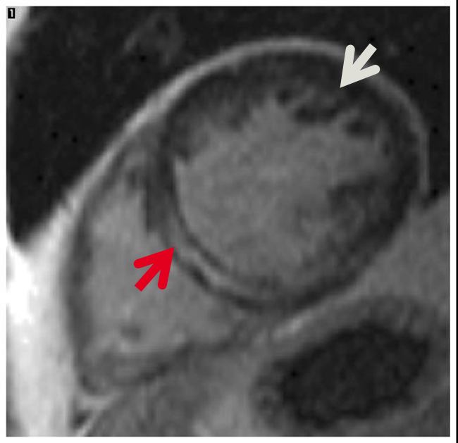 Agent Of My Heart Scan