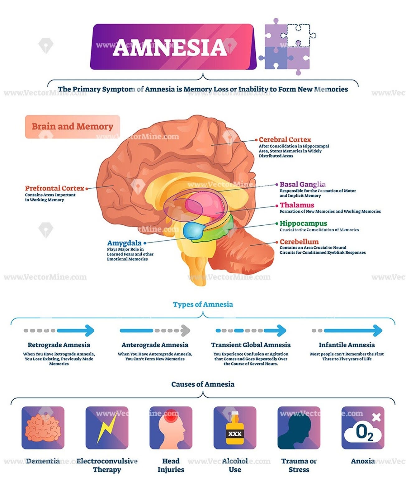 transient epileptic amnesia on Amnesia Know It All All You Need To Know About Memory Loss By Clipo Jan 2021 Medium