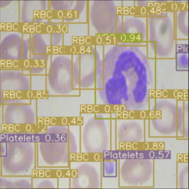 What is Mean Precision (mAP) in Object | by Jacob Solawetz | Towards Data Science