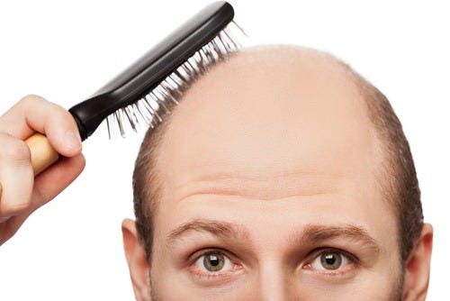 Baldness Signs Symptoms Vcare Trichology Chennai Medium