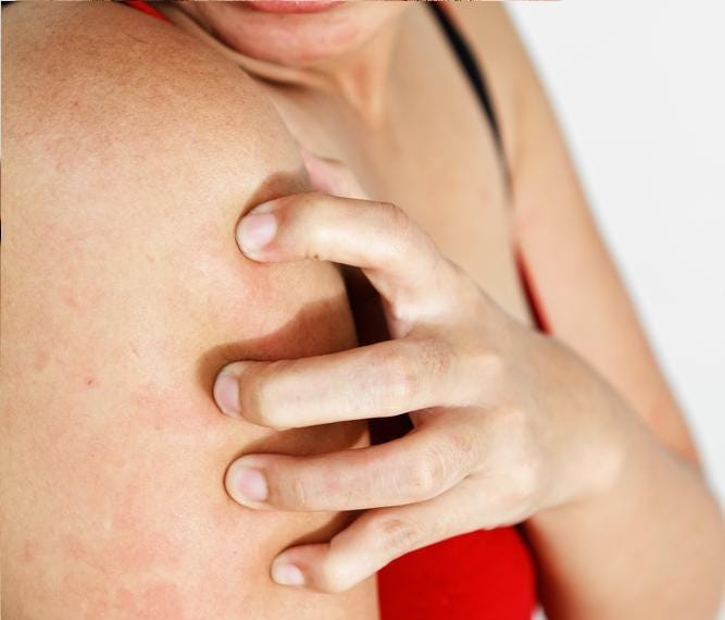 Reasons why your muscles itch after a workout. by Nicklas Lundgren