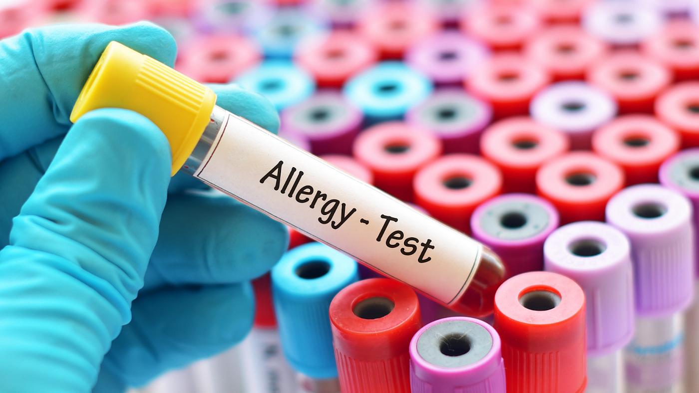 Allergist Near Me How Telemedicine Changed Allergy Care by Gene
