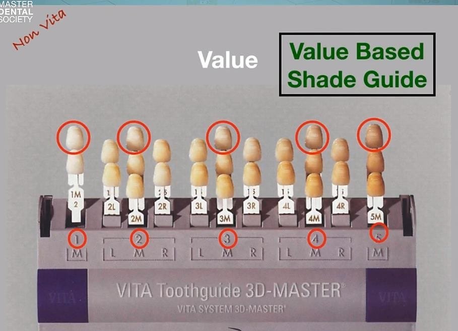 Composite Veneers — Dr.Ahmed Korayem by Free MDS academy Medium