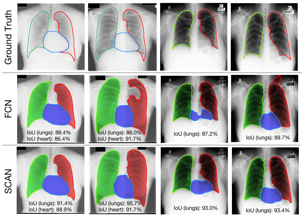 Can AI Read Chest Xrays like Radiologists? by David W. Dai Towards