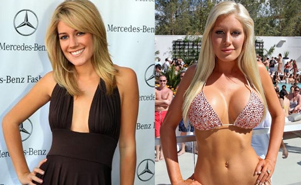 Celebrities With Breast Implants - A Who’s Who of Boob Jobs. 