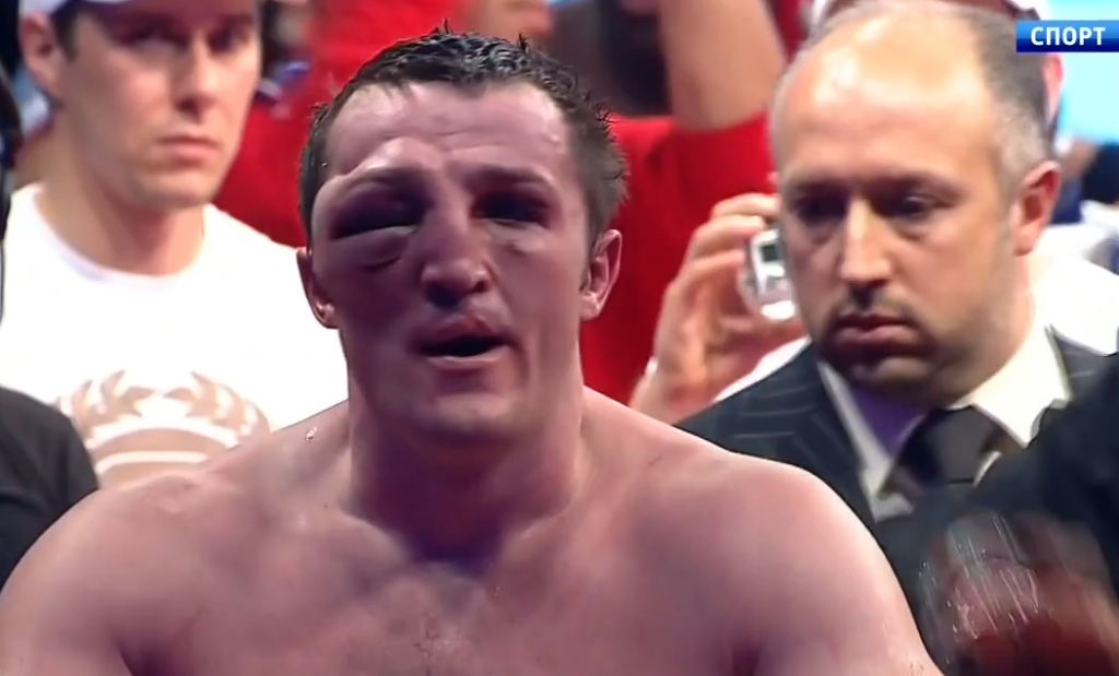 Russian Boxer Suffers Ugly Swollen Eye by Alex B. Ride The Pine