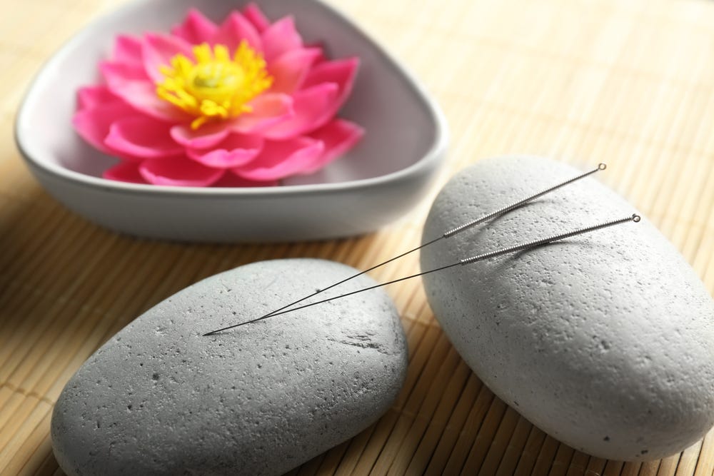 Can Acupuncture Help Reduce Headaches By AmoMama Medium