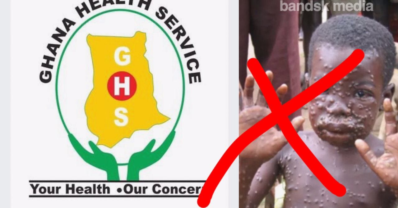 No Monkeypox case recoded in ghana.-GHS