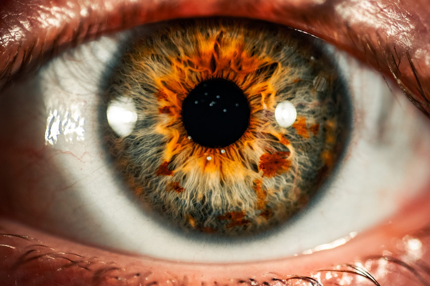 Close-up of an eye. Dietary supplements can reduce the risk of age-related macular degeneration.