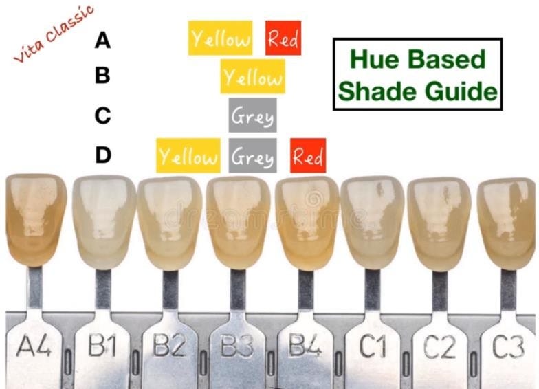 Composite Veneers — Dr.Ahmed Korayem by Free MDS academy Medium