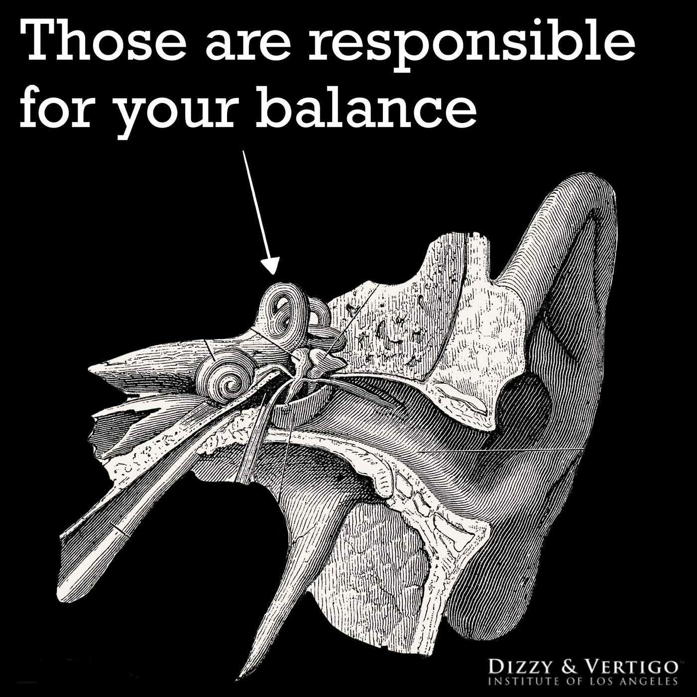 What is Benign Paroxysmal Positional Vertigo and How is BPPV Treated