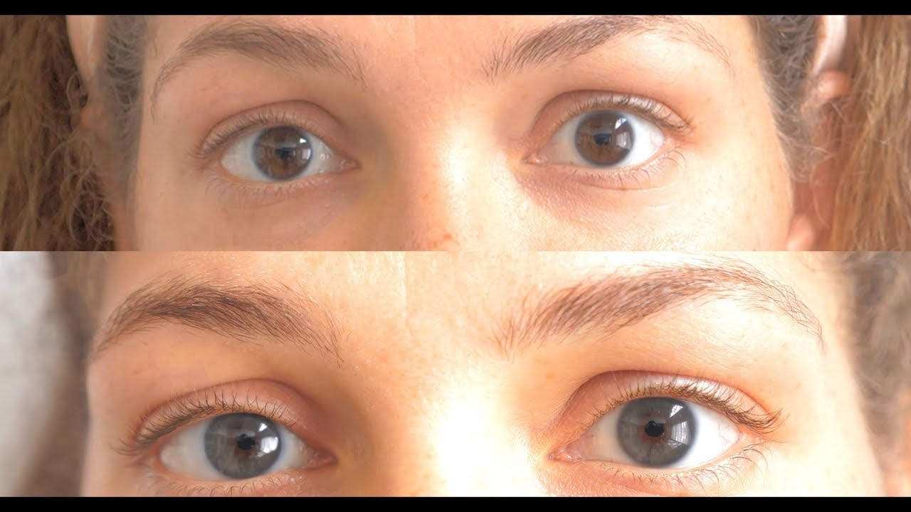 Change Eye Color Permanently With Laser Procedure Bheldi Blogs