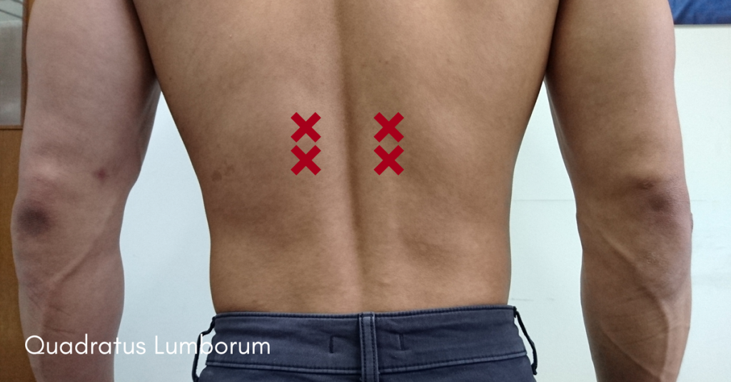 How To Identify Your Muscle Knots (And Where To Find Them) by