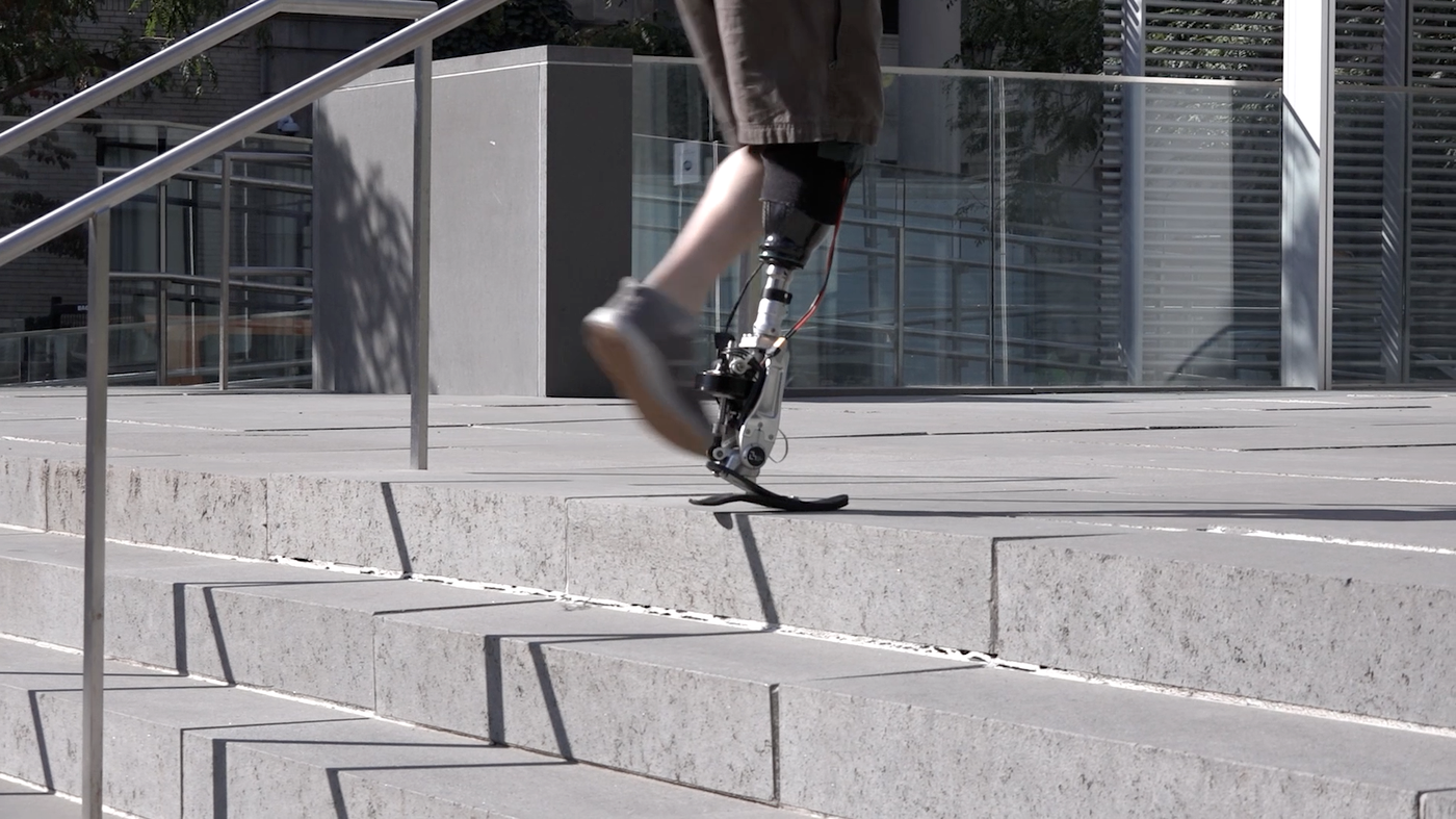 A man with a prosthetic leg climbs stairs